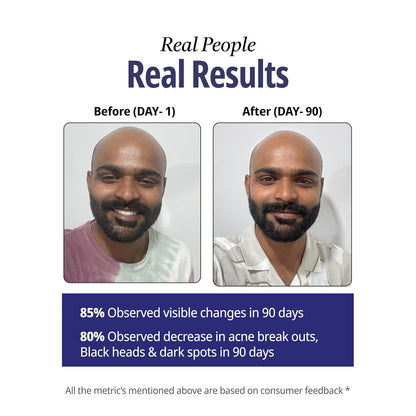 Before and after comparison of a man with text about observed changes in 90 days.