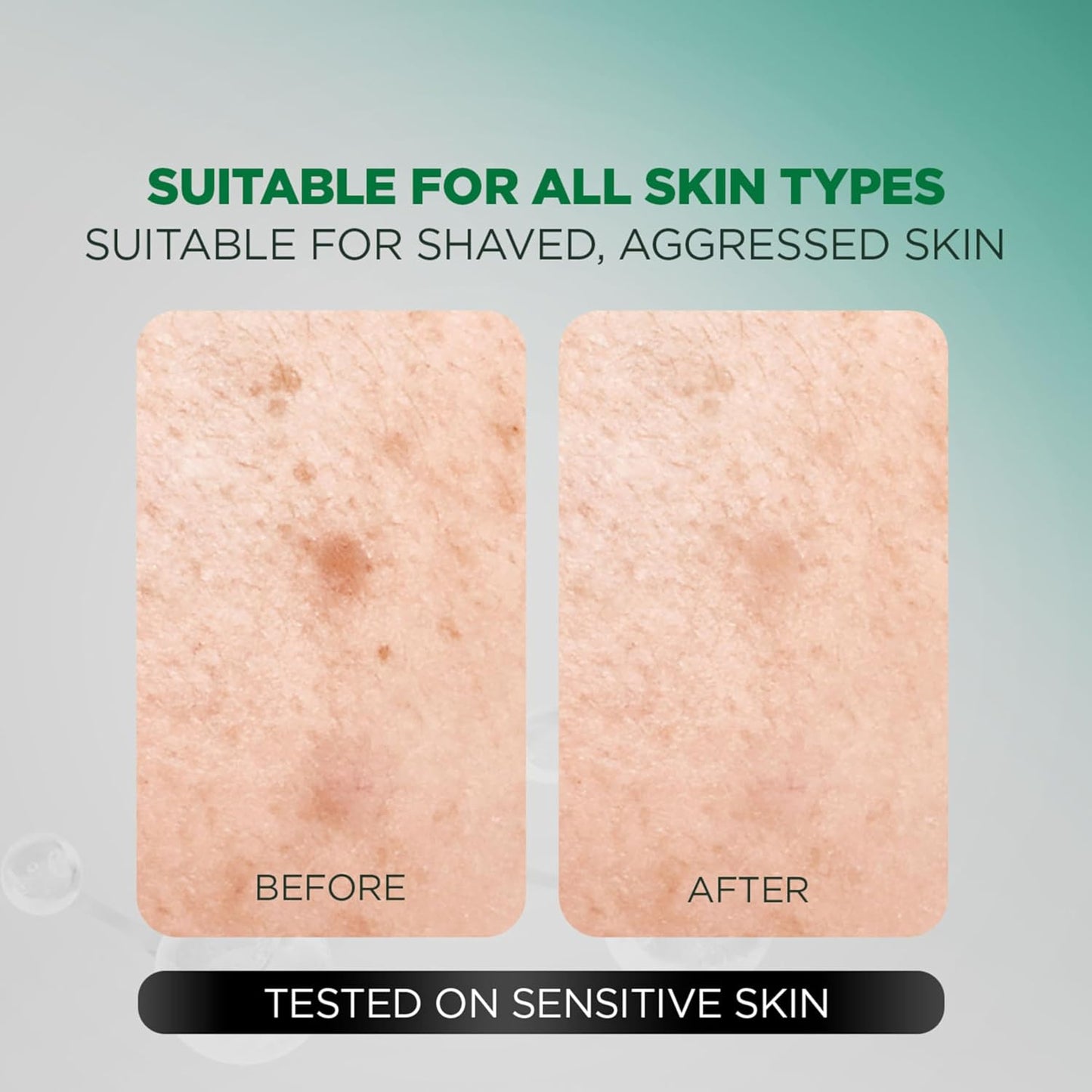 Before and after comparison of skin texture with text indicating suitability for all skin types.
