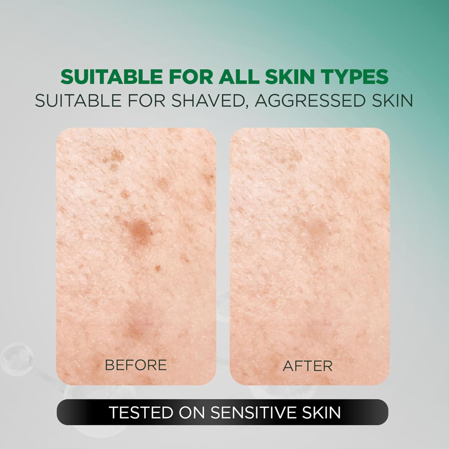 Before and after comparison of skin texture with text indicating suitability for all skin types.