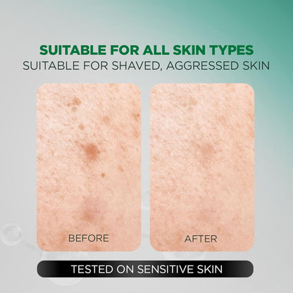 Before and after comparison of skin texture with text indicating suitability for all skin types.