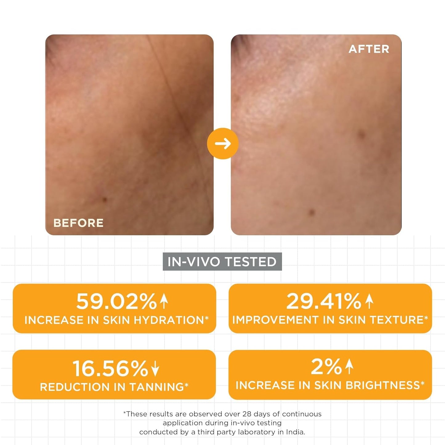 SKINQ Brightening Serum for Women with Licorice & Lactic Acid | Face Elixir for Tan, Pigmentation & Dark Spots | Exfoliates, Brightens & Softens | Helps Repair & Heal Sun-Damaged | 15ml