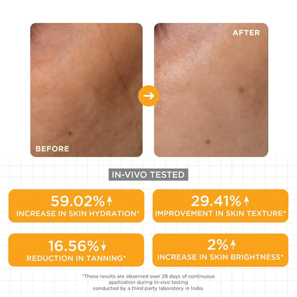 SKINQ Brightening Serum for Women with Licorice & Lactic Acid | Face Elixir for Tan, Pigmentation & Dark Spots | Exfoliates, Brightens & Softens | Helps Repair & Heal Sun-Damaged | 15ml
