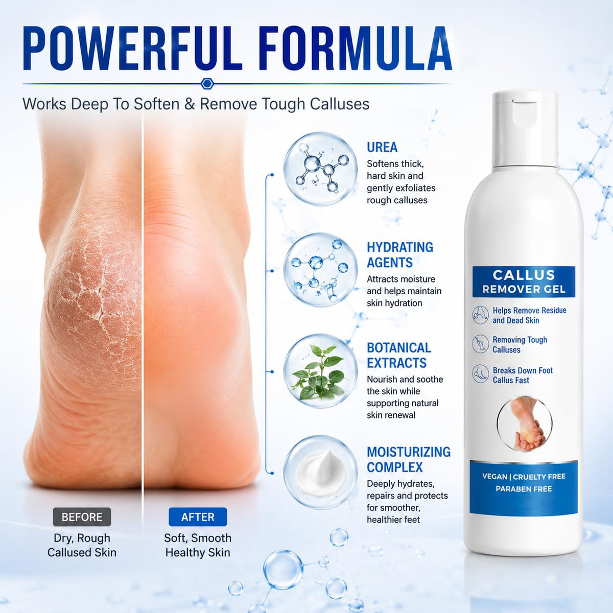Callus Remover Gel for Feet, Softening and Exfoliating Formula, Dry Rough Skin Care, 200ml, for Men and Women