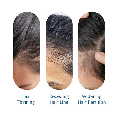 Be Bodywise 3% Redensyl & Rosemary Hair Growth Serum (Roll On) | Pack of 2 |with 2% Anagain | Thicker & Stronger Hair | Prevents Hairfall & Stimulates Hair Follicles | For All Hair Types | 25ml each