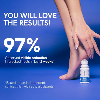 Be Bodywise 20% Urea Foot Cream Roll On 50ml | For Dry & Cracked Heels | With 2% Lactic Acid, Olive Oil & Vitamin E | Helps Repair and Moisturise Cracked Heels