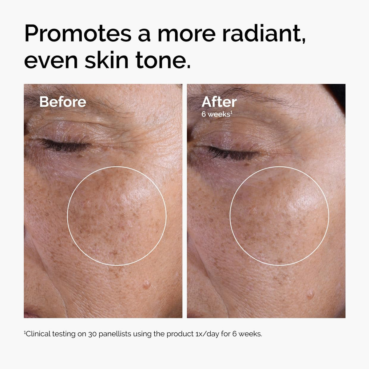 Before and after comparison of skin texture with text indicating product's effect on skin tone.