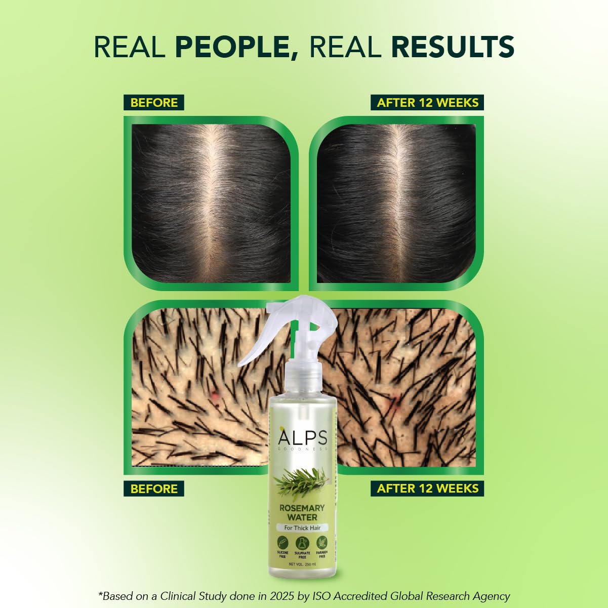 Alps Goodness Rosemary Water Spray for Hair Growth (250ml) | Clinically Proven (In Vivo Tested) to Reduce Hair Fall & Promote Regrowth | 100% Natural Rosemary Extract | Leave-On Scalp & Hair Spray For Men & Women