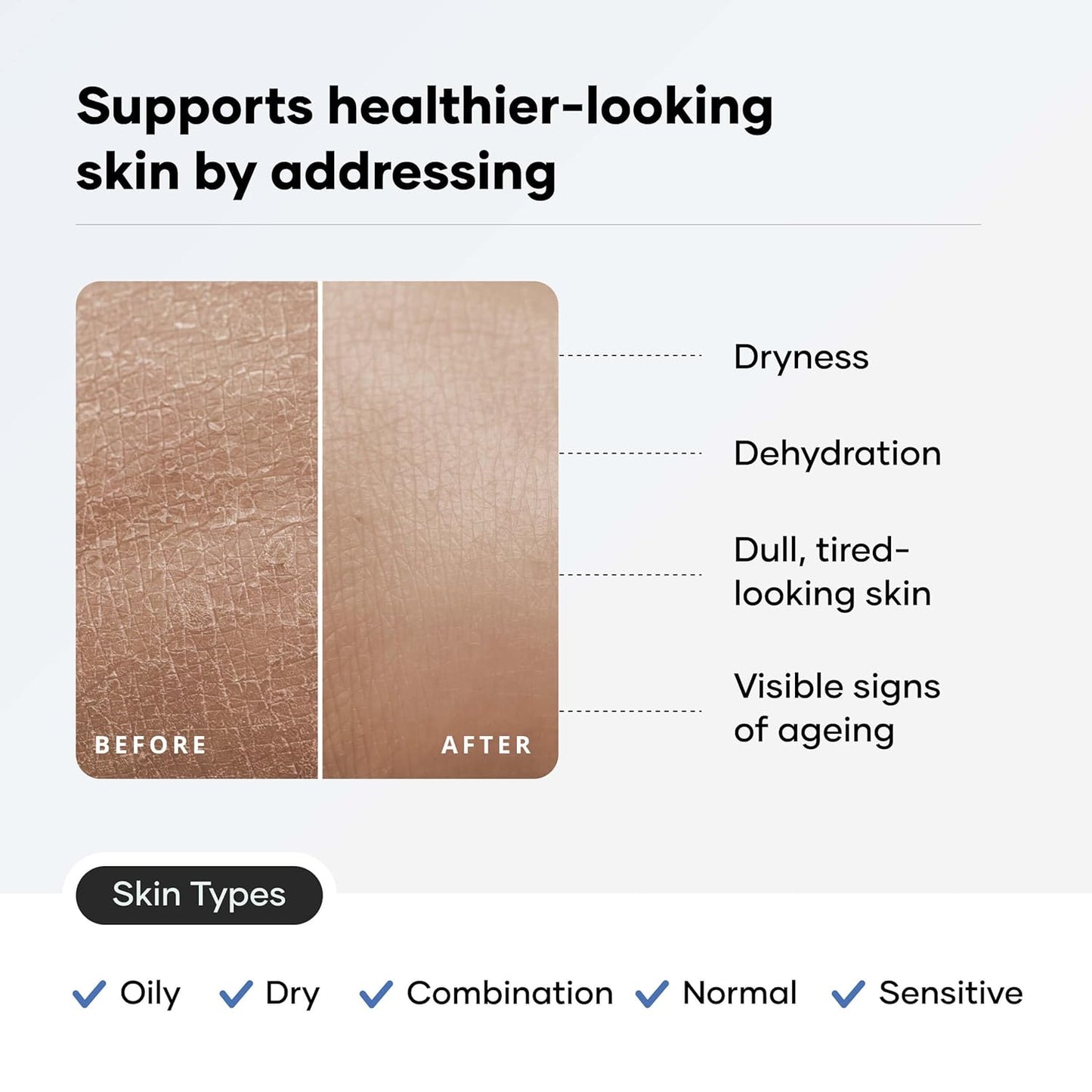 Cureskin Ceramide Moisturiser SPF 40 PA+++ Skin Barrier Repair Face Moisturizer for Men and Women | Hyaluronic Acid Moisturizer for Face | Anti Aging Cream for Women and Men
