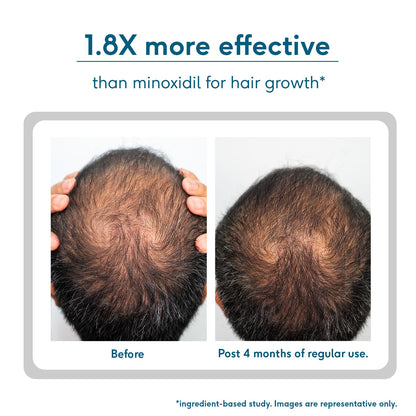HK Vitals by HealthKart Headful Growth+ Serum with 3% Redensyl™, 3% Procapil™, & 5% Capixyl™ (30ml) | For Hair Growth & Hair Fall Control | Dermatologically Tested