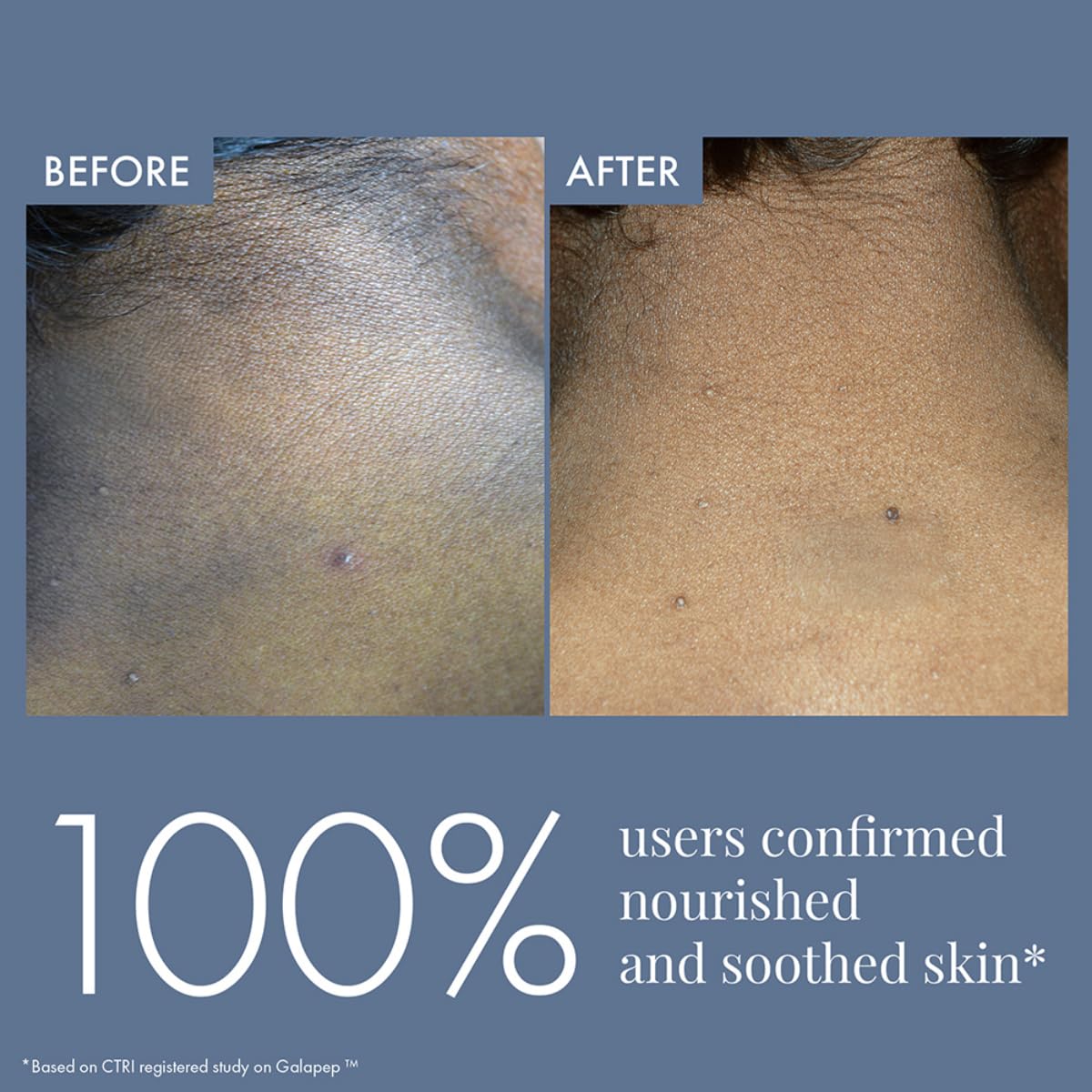 Before and after comparison of skin nourishment with text indicating 100% user satisfaction.