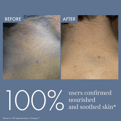 Before and after comparison of skin nourishment with text indicating 100% user satisfaction.