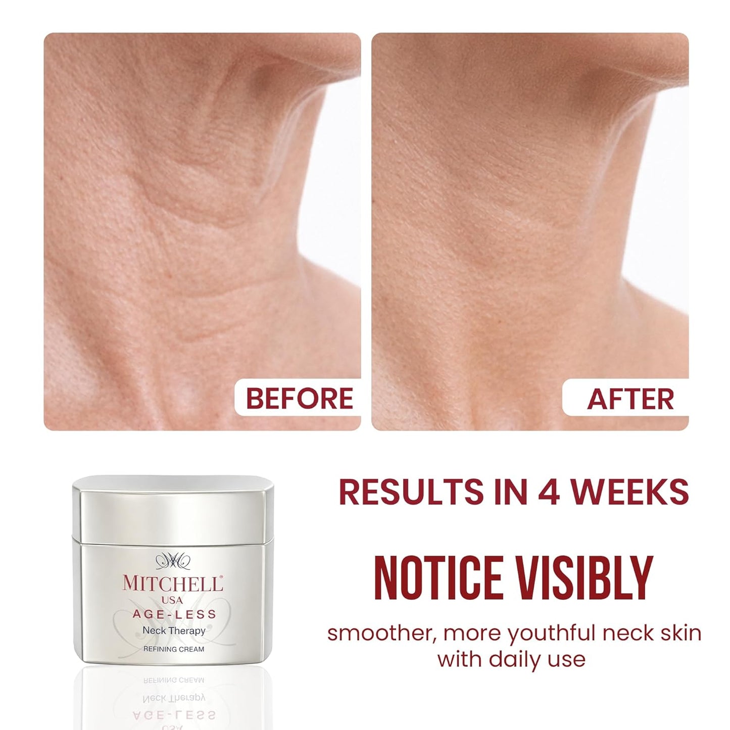 Mitchell USA Anti-Aging Neck Therapy Cream – Firms & Smooths Neck Skin, Reduces Fine Lines | With Lotus Seed Extract & Cocoa Butter | For All Skin Types | 50 g