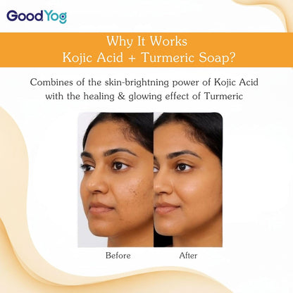 GoodYog 2% Kojic Acid Soap (100g, Pack of 2) with Turmeric for Pigmentation, Dark Spots & Tan Removal | For Dark Underarms, Knees & Elbows | For Men & Women - 200g