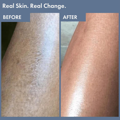 Before and after comparison of skin texture on a leg, with text 'Real Skin. Real Change.'