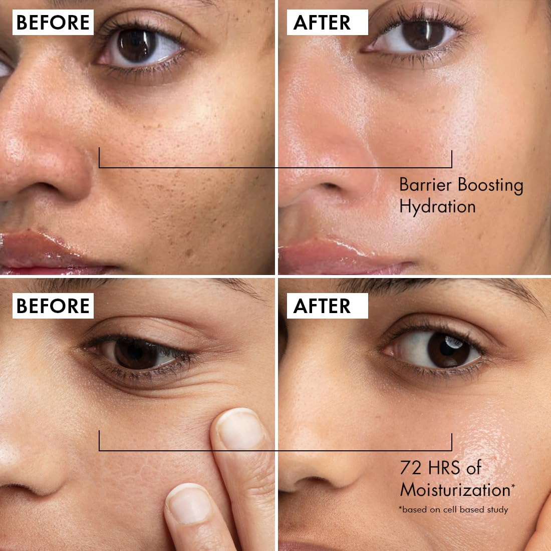 Before and after comparison of barrier boosting hydration and 72 hours of moisturization on a person's face.