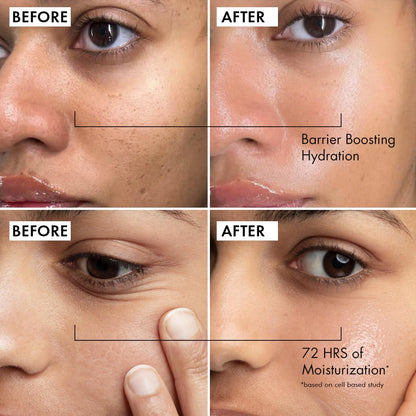 Before and after comparison of barrier boosting hydration and 72 hours of moisturization on a person's face.