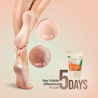 Moha Foot Cream for Dry & Cracked Feet | Deep Nourishment & Fast Healing Heel Repair Cream | Cooling & Vegan Formula with Aloe, Papaya, Peppermint & kapurkachri | Clinically Proven | Moisturizing Foot Cream for Rough Calloused Skin 100gm