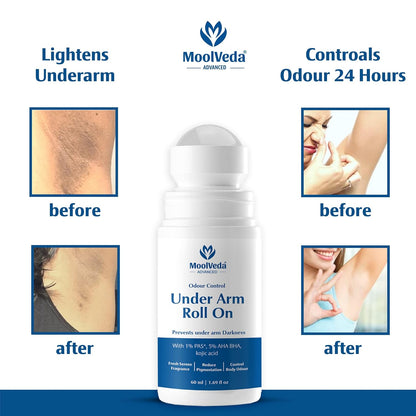 MoolVeda Under Arm Roll On with before and after effects on skin and odor control.