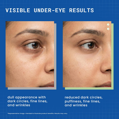 DERMDOC Niaglow 4% Niacinamide Under Eye Gel, 15gm | Reduces Dark Circles & Puffiness | Cools & Soothes | Lightweight | Fast Absorbing | Brightening Eye Care Gel for Tired Eyes & Fine Lines