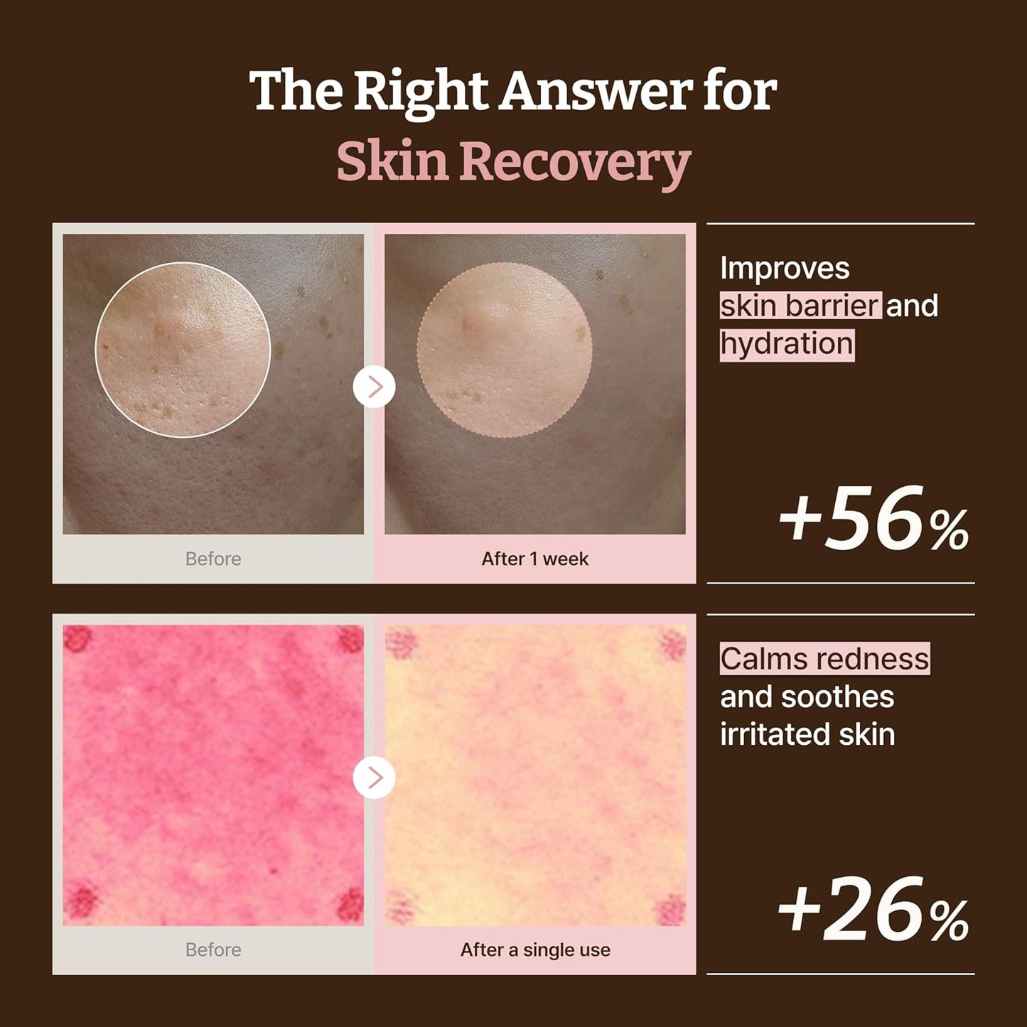 Dr.Reju-All Advanced PDRN Rejuvenating Cream | Korean PDRN Face Cream with 99% Pure Salmon DNA, Niacinamide & Collagen | Deep Hydration, Anti-Aging, Skin Repair, Elasticity Boost, Barrier Repair & Brightening Moisturizer (20ml)