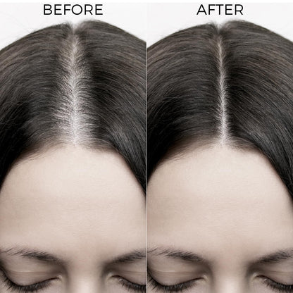 Brillare 10% Rosemary Hair Oil for Hair Growth with 10% Olive Oil & 5% Castor oil | Reduces Hair Fall | Strengthens Hair | Visible Results in 4 Weeks.