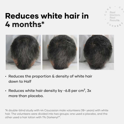 Cureskin Anti Grey Hair Serum | Gradually Reduces Gray Hair on Head & Beard Without Dye | Restores Natural Hair Colour in 4 months with Peptide-52, Acetyl Tyrosine & Larix Extract (15 Days Supply)