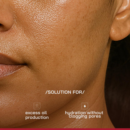 /PHD/ 3% Niacinamide Oil-Free Moisturizer | Face Moisturizer for Oily & Acne-Prone Skin | Lightweight Gel for Men & Women with CICA & Tripeptide | Hydrates & Controls Oil | 50 g