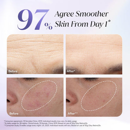 Before and after skin improvement results with 97% agreement on smoother skin from day one.
