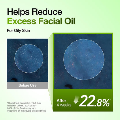 Anua Azelaic Acid 10 Hyaluron Redness Soothing Serum with Cica Soothes & Calms Acne-Prone Skin