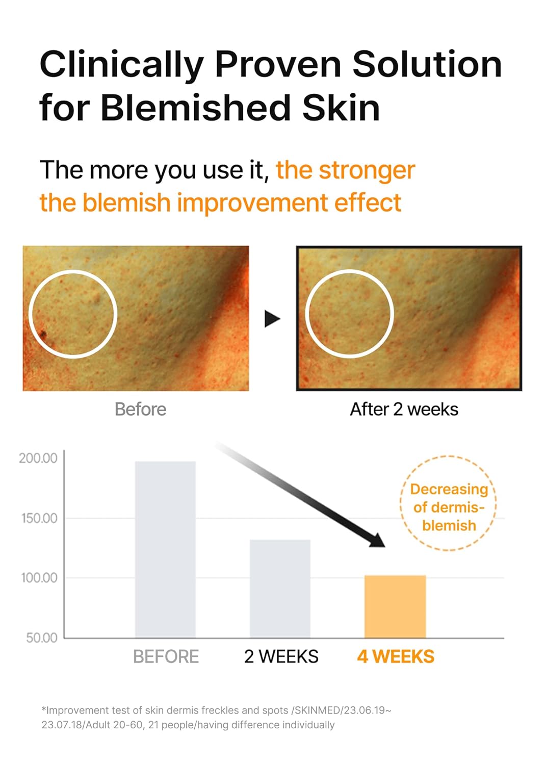 celimax Pore+Dark Spot Brightening Serum 30ml | Gel-like Serum for Enlarged Pores with Niacinamide, Pore Minimizer, Non-Irritating, Hydrating, For Sensitive Skin