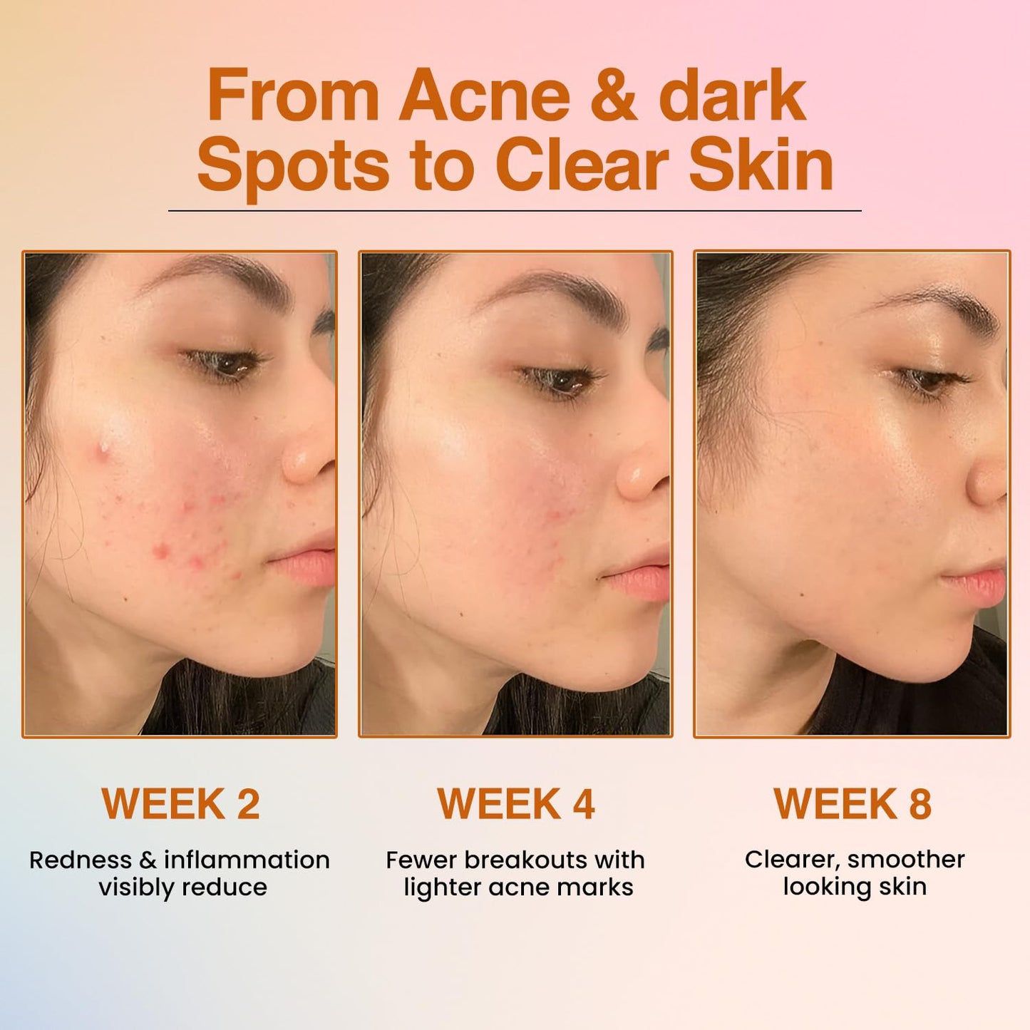 Before and after skin improvement over 8 weeks with text indicating results.