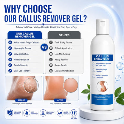 Callus Remover Gel for Feet, Softening and Exfoliating Formula, Dry Rough Skin Care, 200ml, for Men and Women