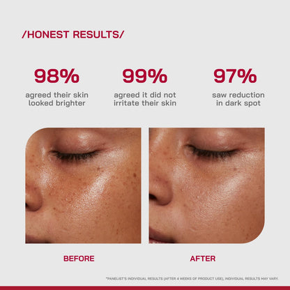 /PHD/ 10% Vitamin C Brightening Serum | For Glowing skin, Oily skin, Dry skin | Dark Spots & Uneven Tone Treatment | Face serum for Women & Men | Formulated with Global Dermatologists 30ml