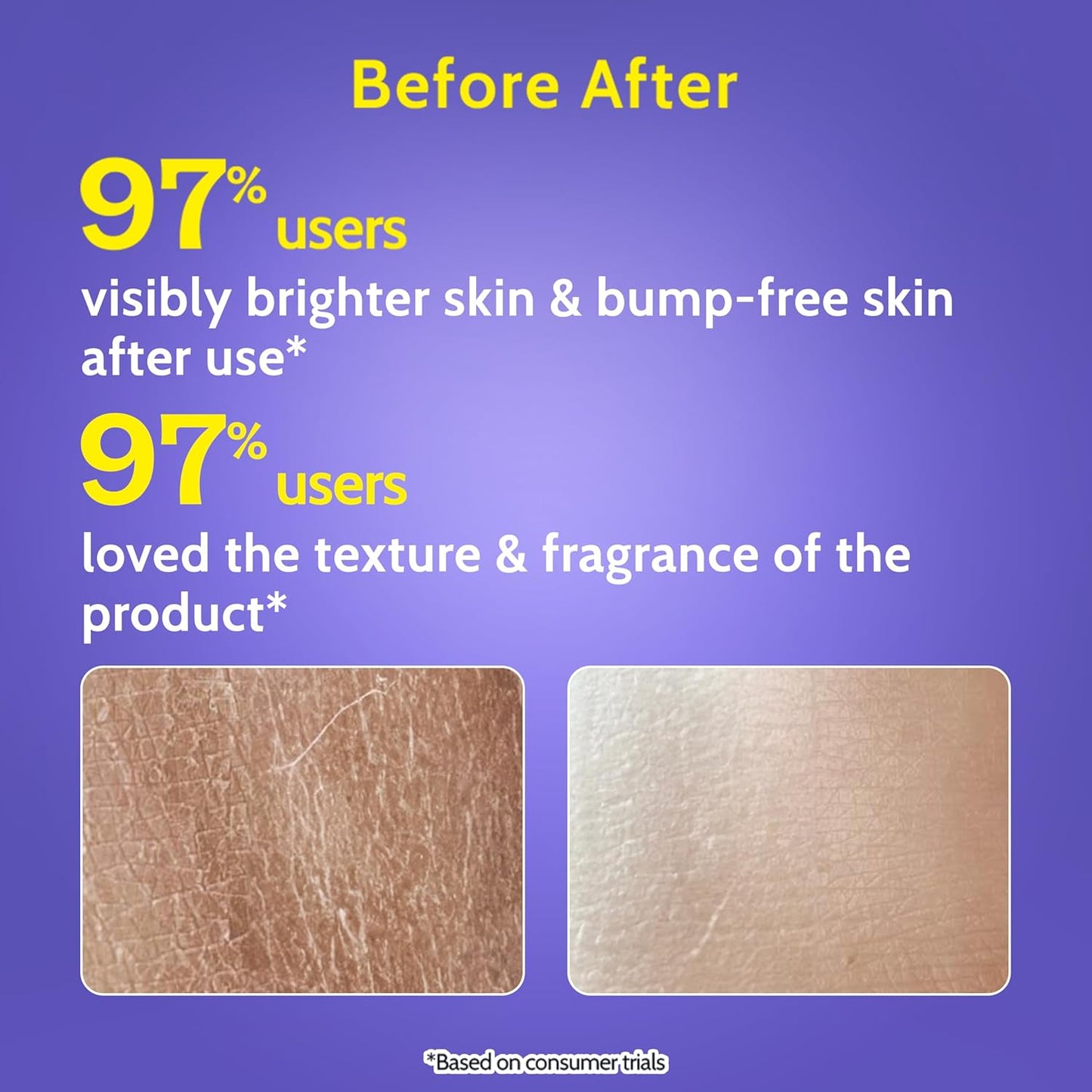 Chemist At Play Exfoliating Body Wash 236ml | 4% (Salicylic Acid, Vitamin E & Lactic Acid) | Paraben & SLS Free | Gentle Exfoliating Shower Gel | Removes Tan | Prevents Dry, Rough, Bumpy Skin | Unisex