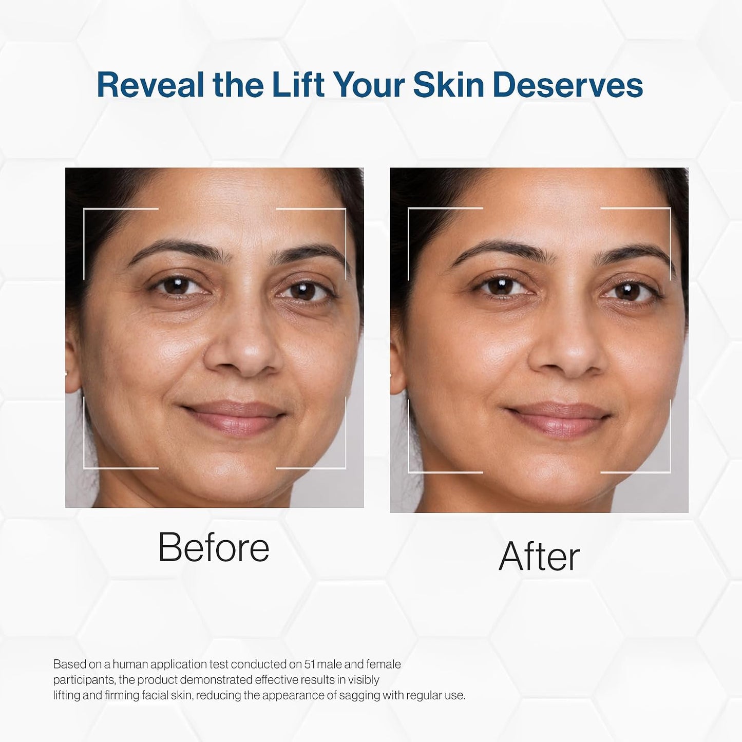 FCL Face Lift Matrix with Retinal & MATRIXYL 3000, 30g | Wrinkle & Fine Lines