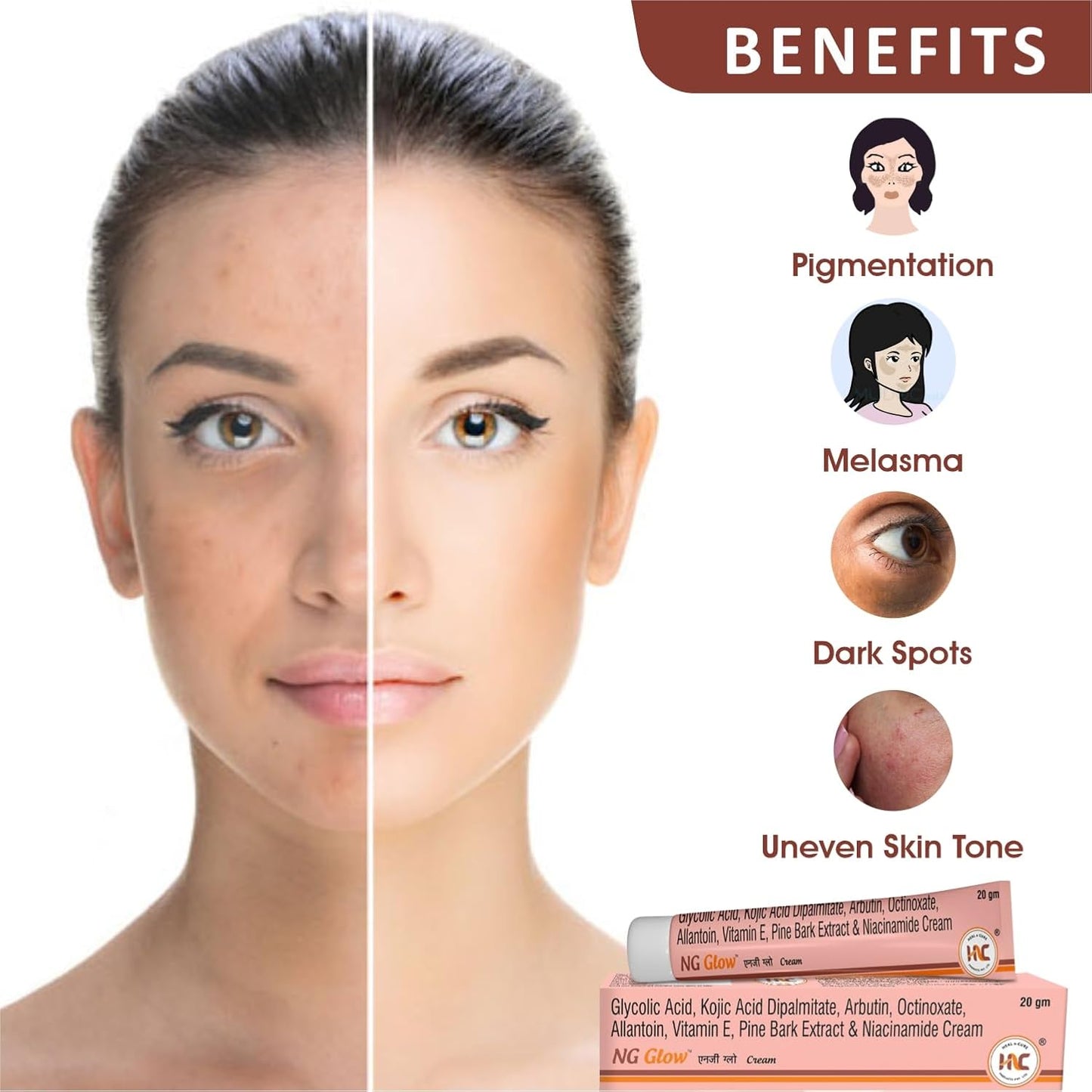 Heal N Cure NG Glow Cream - Enriched With Kojic Acid &Glycolic Acid | Anti-melasma & Anti Pigmentation Cream. Helps To Remove Acne Scar, Dark/Age Spots, Blemishes and Uneven Skin Tone-20GM