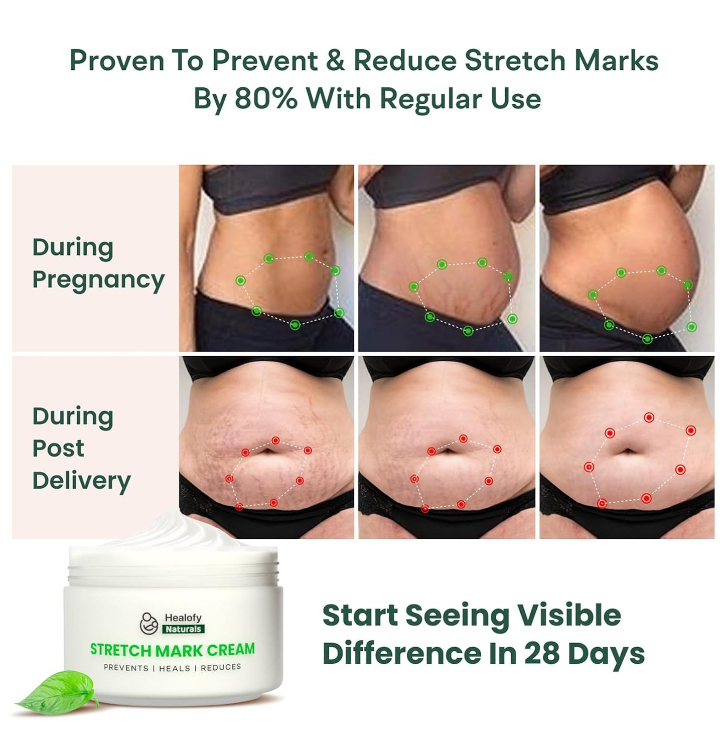 Healofy Stretch Marks Cream for Pregnancy & Post-Delivery | Reduces Stretch Marks & Scars | Blend of Oil & Butters | With Aloe Vera, Shea. Cocoa, Coconut & More| Pack of 1-100 grams