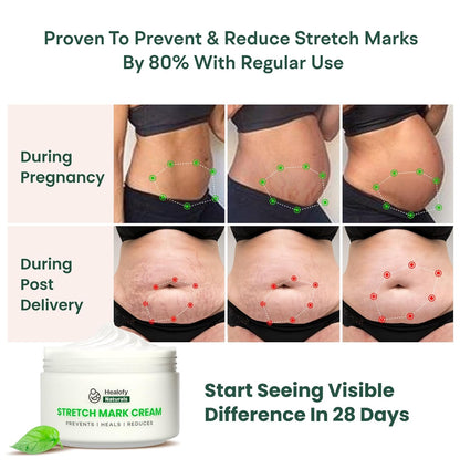 Healofy Stretch Marks Cream for Pregnancy & Post-Delivery | Reduces Stretch Marks & Scars | Blend of Oil & Butters | With Aloe Vera, Shea. Cocoa, Coconut & More| Pack of 1-100 grams