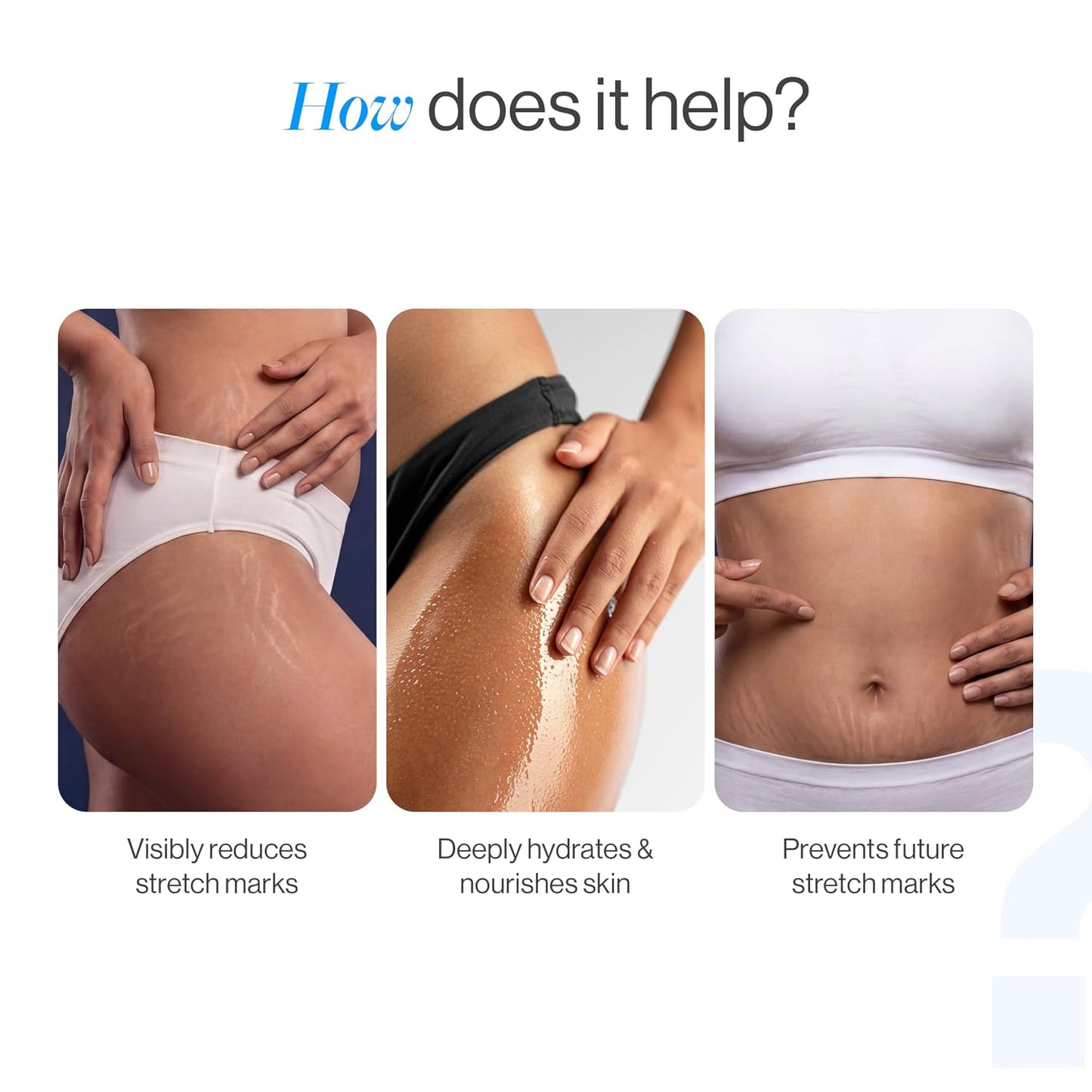 Be Bodywise Anti Stretch Mark Roll-On Serum 50 ml | With Regeneryl, STRIOVER™ & Bakuchiol Oil | Fades & Reduces Stretch Marks, Hydrates & Stimulates Collagen Production | Non-sticky & Non-messy