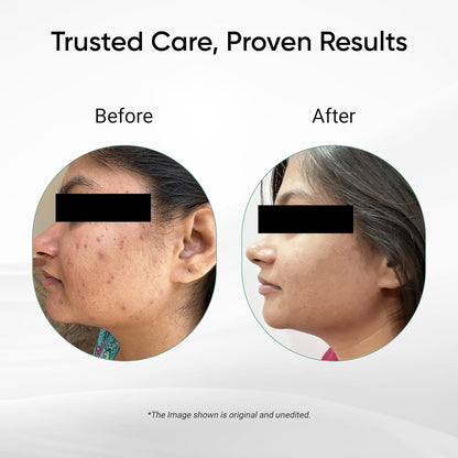 Multipurpose Herbal Cream 25g (Pack of 2), Gentle & Chemical Free Triple Action Healing Cream, Ideal for First-Aid, Minor Cuts, Wounds & Burns