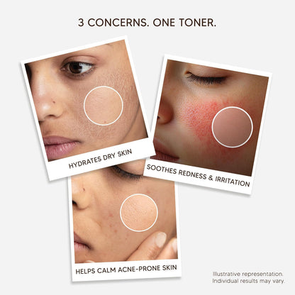 Soyaang Pure Centella Tranquil Toner with Niacinamide, Glucono-Delta-Lactone & Hyaluronic Acid | Calms Redness, Refines Pores & Hydrates | Alcohol-Free | 75ml
