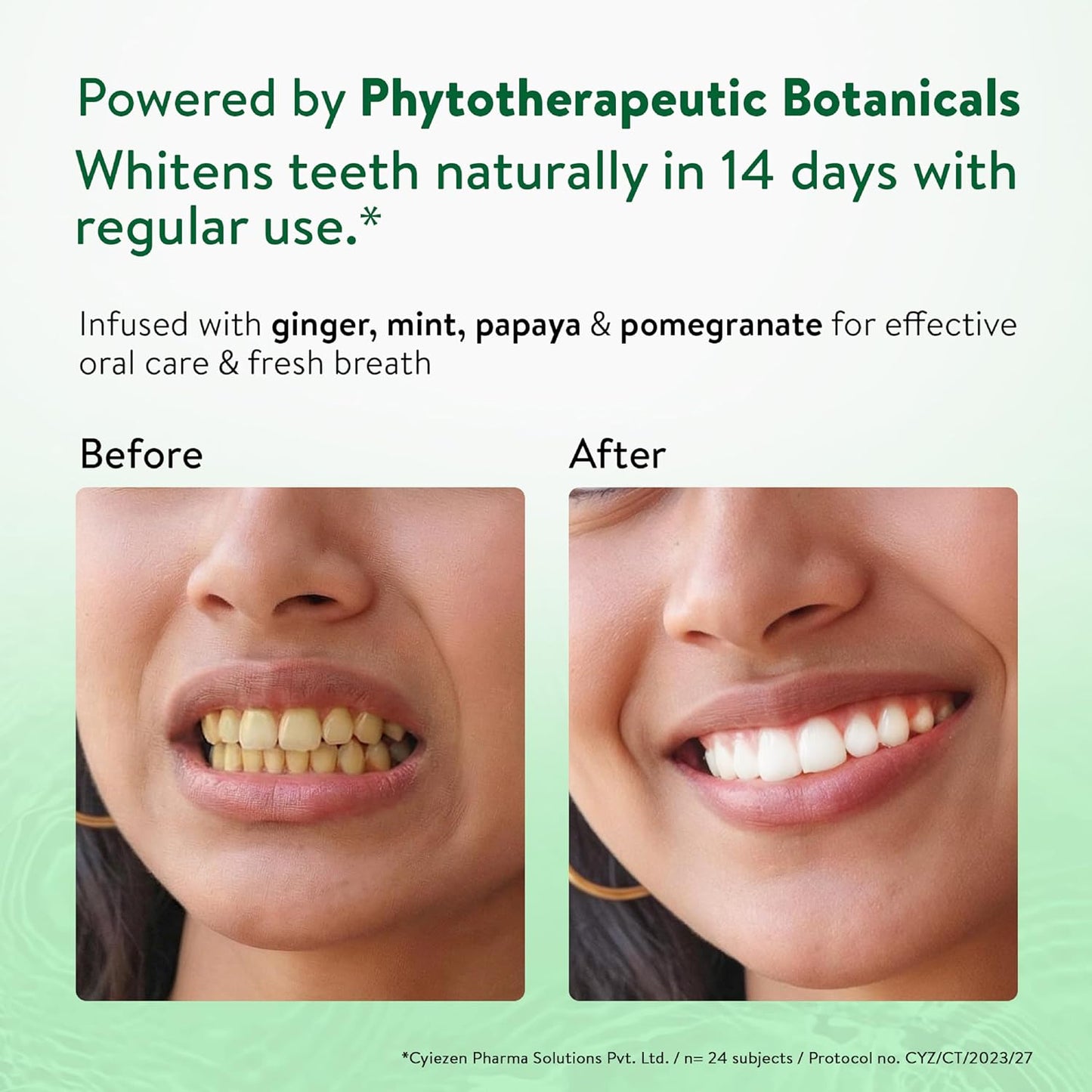 Ayouthveda Ayurvedic Natural Whitening Toothpaste | Plant-Based Formula with Ginger, Mint, Papaya & Pomegranate | Plaque & Tartar Control | Gum Comfort, Enamel Care & Fresh Breath | 100g (Pack of 1)