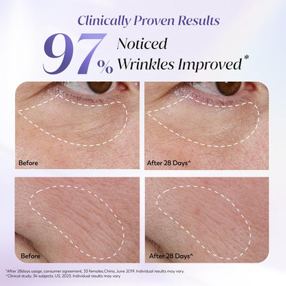 Before and after skin treatment results showing wrinkles improvement with text 'Clinically Proven Results 97% Wrinkles Improved'.