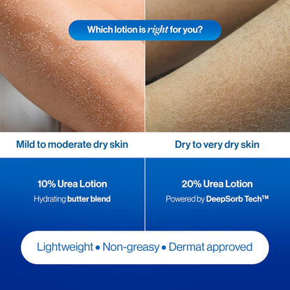 Comparison of dry skin on legs with text about urea lotion options and benefits.