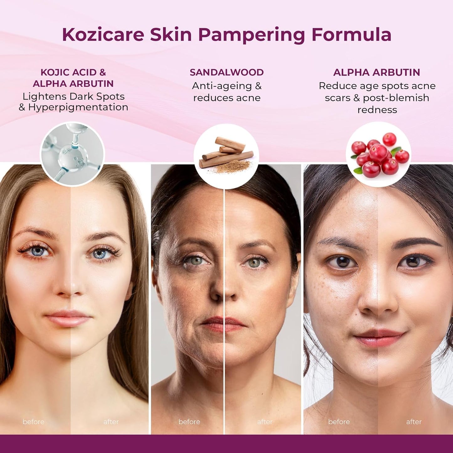 Kozicare Kojic Acid Cream | Real Sandalwood | Moisturizer For Dry Skin | Detan | Tan Removal | Face For Summer Daily Use| Face For Women & Men - 15gm