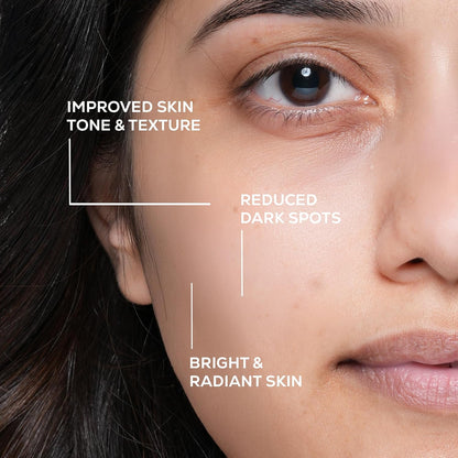 RENEE Everyday Face Bright Illuminating Face Serum | Reduces Dark Spots & Acne, Brightens Skin, Improves Complexion & Radiance | For All Skin Types | With Glutathione, Niacinamide & Vitamin C | 30ml