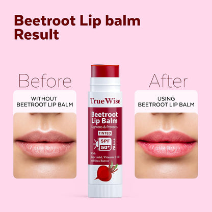 Tinted Lip Balm with SPF 50 PA+++ Brightening Beetroot Lip Balm For Dark Lips With Kojic Acid,Vitamin E, Soft, Glossy Lips- SPF lip balm for Women 5g