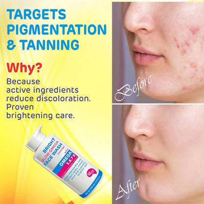 Advertisement for a face wash targeting pigmentation and tanning with 'Before' and 'After' skin comparisons.