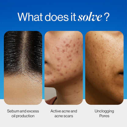 Be Bodywise 2% Salicylic Acid Face Wash for Acne Prone skin | For Oily & Sensitive skin | Deep Cleanses your Skin & Prevents Acne | Developed by Dermatologists | 100ml