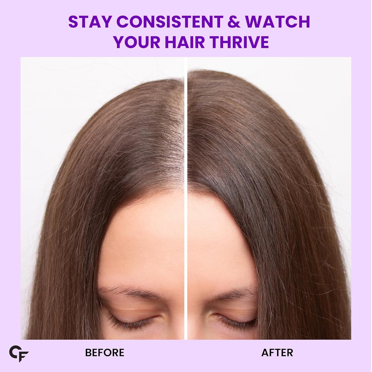 Carbamide Forte Biotin Tablets for Hair Growth with Amla, Brahmi & Bamboo Extract | Hair Growth Tablet | Hair Vitamins | Hair Supplements for Women & Men - 90 Veg Tablet